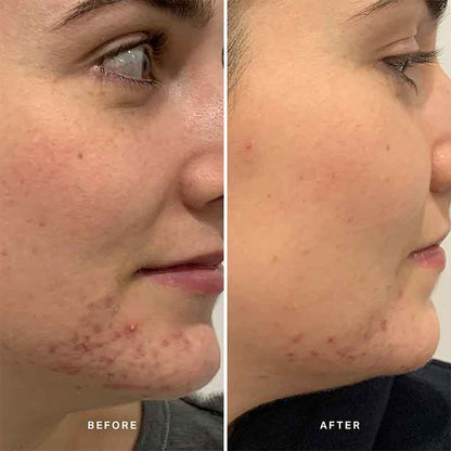 Alpha-H Clear Skin Tonic with 2% Salicylic Acid + Niacinamide