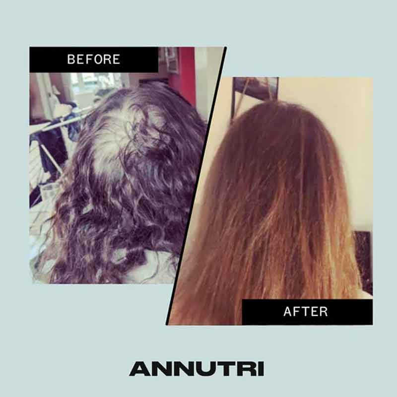 Annutri Grow It Hair Growth Supplement - 6 Month Supply