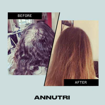 Annutri Grow It Hair Growth Supplement - 6 Month Supply