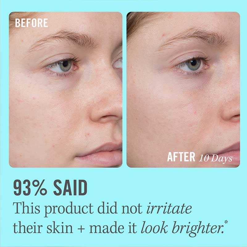 First Aid Beauty 10% Vitamin C Brightening Serum Discontinued